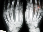 PROTECCION RADIOLOGICA A BAJAS DOSIS