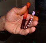 G.I.E.M.S.A., BIOLOGIA VASCULAR Y HEMATICA