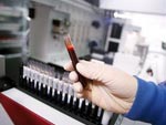 MICROBIOLOGIA Y HEPATOLOGIA